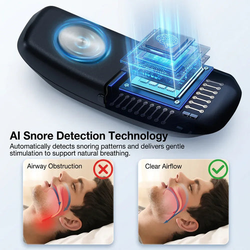 Sleepzia™ intelligent Anti Snoring Device - Sleepzia™
